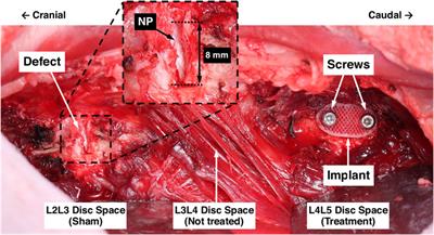 Biomechanical evaluation of a novel repair strategy for intervertebral disc herniation in an ovine lumbar spine model